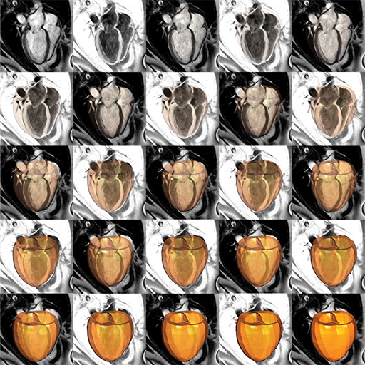 The heart is an amazing biological machine; a 'clockwork' which (almost) never fails. Every single muscle cell in this clock works at precisely timed moments in unison to pump blood through the body. This work presents a series of snapshots of a beating heart that were taken using the magnetic resonance imaging (MRI) technique. From these images a doctor can tell a healthy heart from a failing one. In the course of studying the mechanical functions of the failing heart I've come to appreciate the sheer miracle of each well-delivered beat; the miracle of being alive in this very second, and the next.