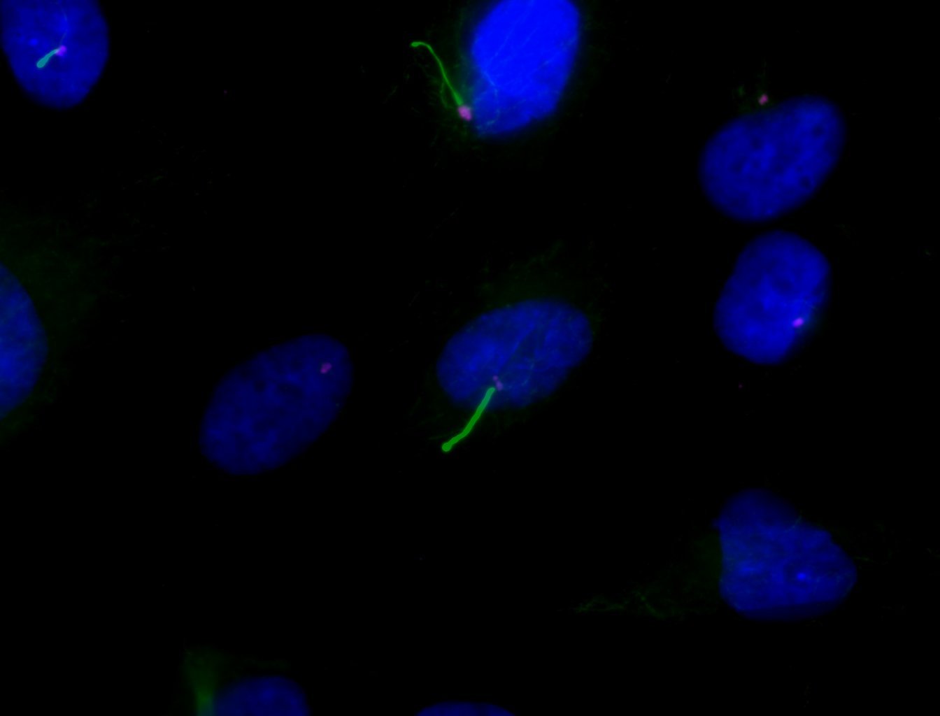 2024-02-08 RPTEC cilia 1 - 250k cells no SFM.jpg