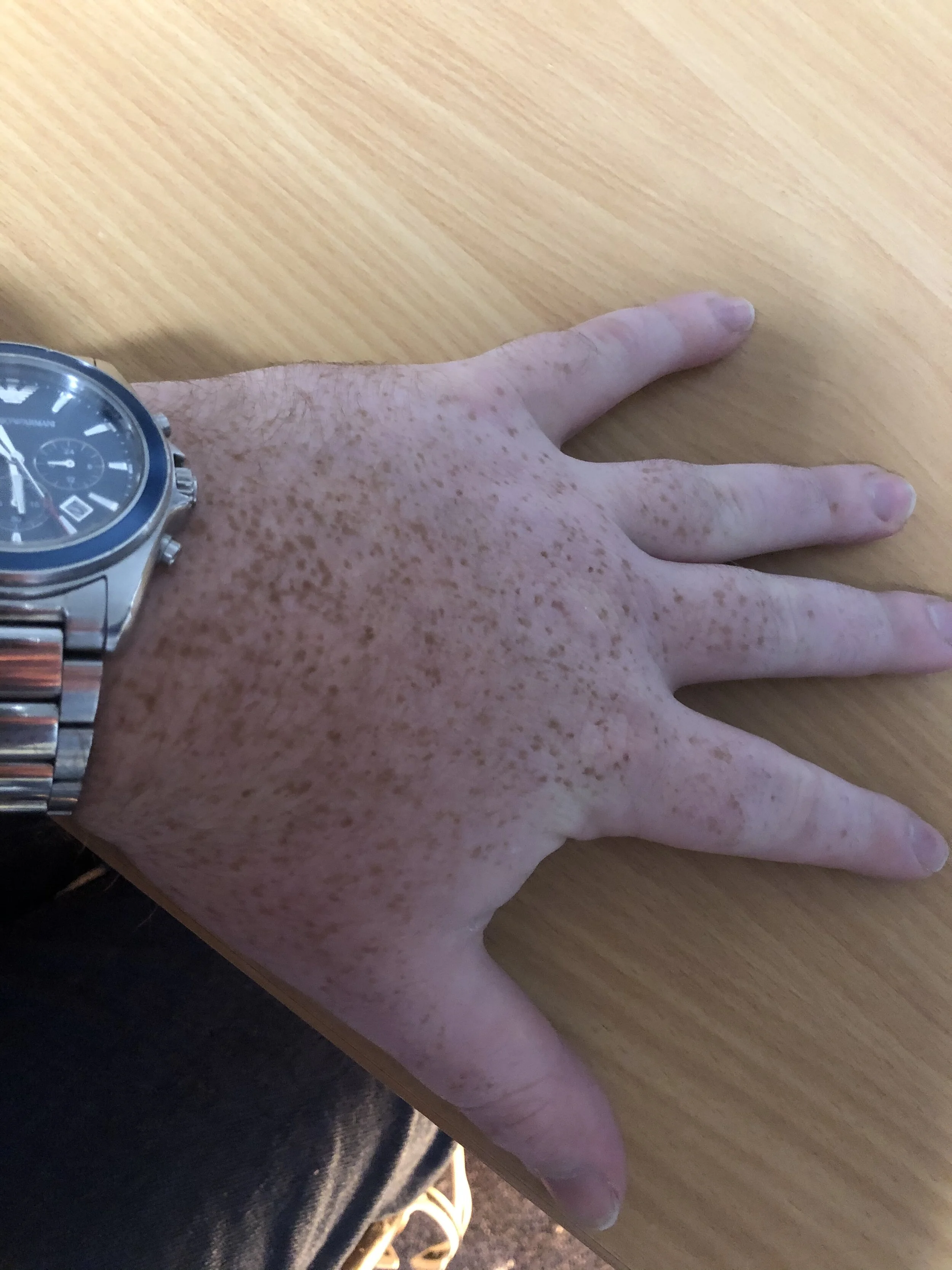 the pandemic has saved my life