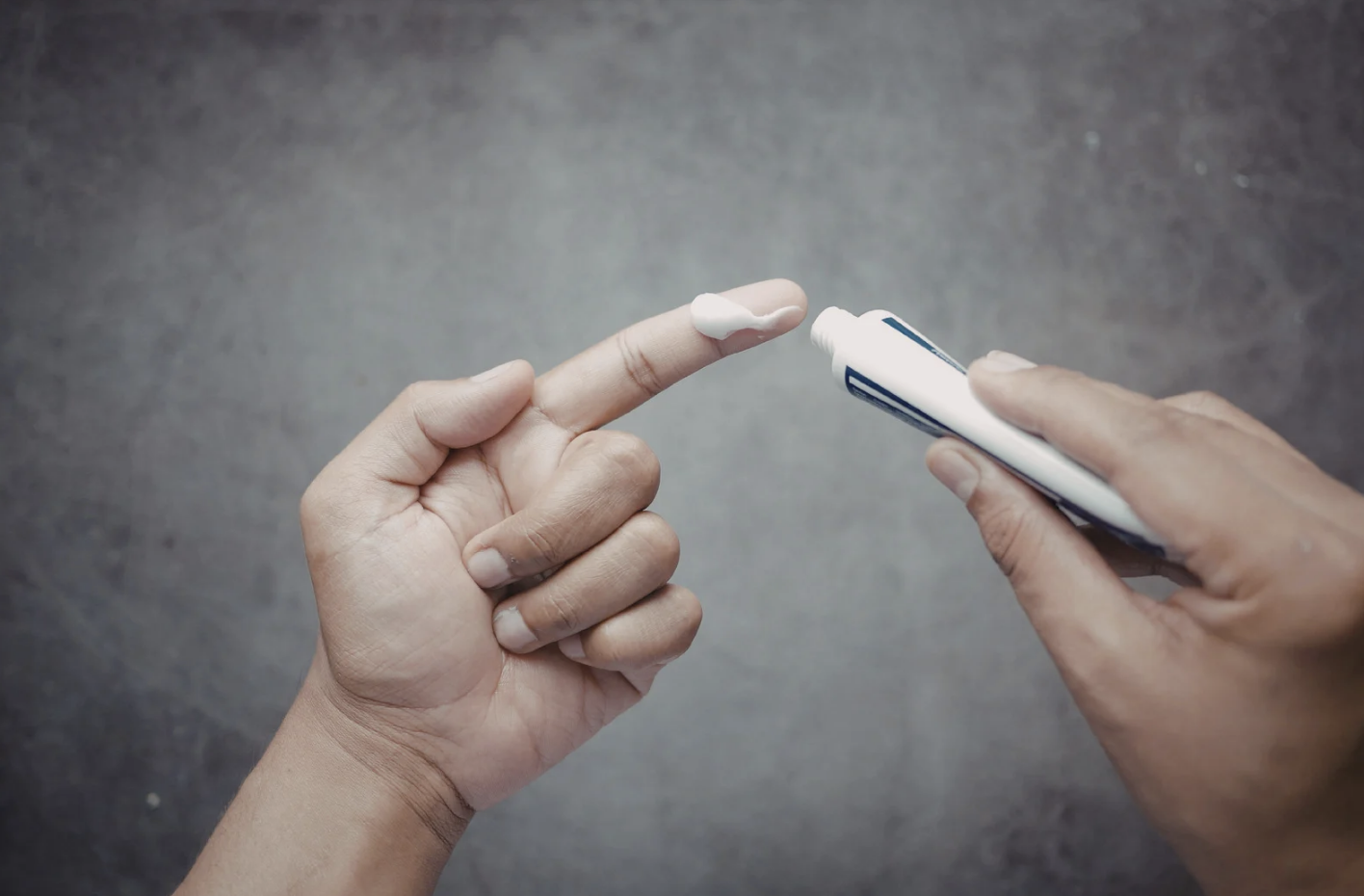 Using Steroid Creams Correctly for Eczema: An Evidence-Based Guide