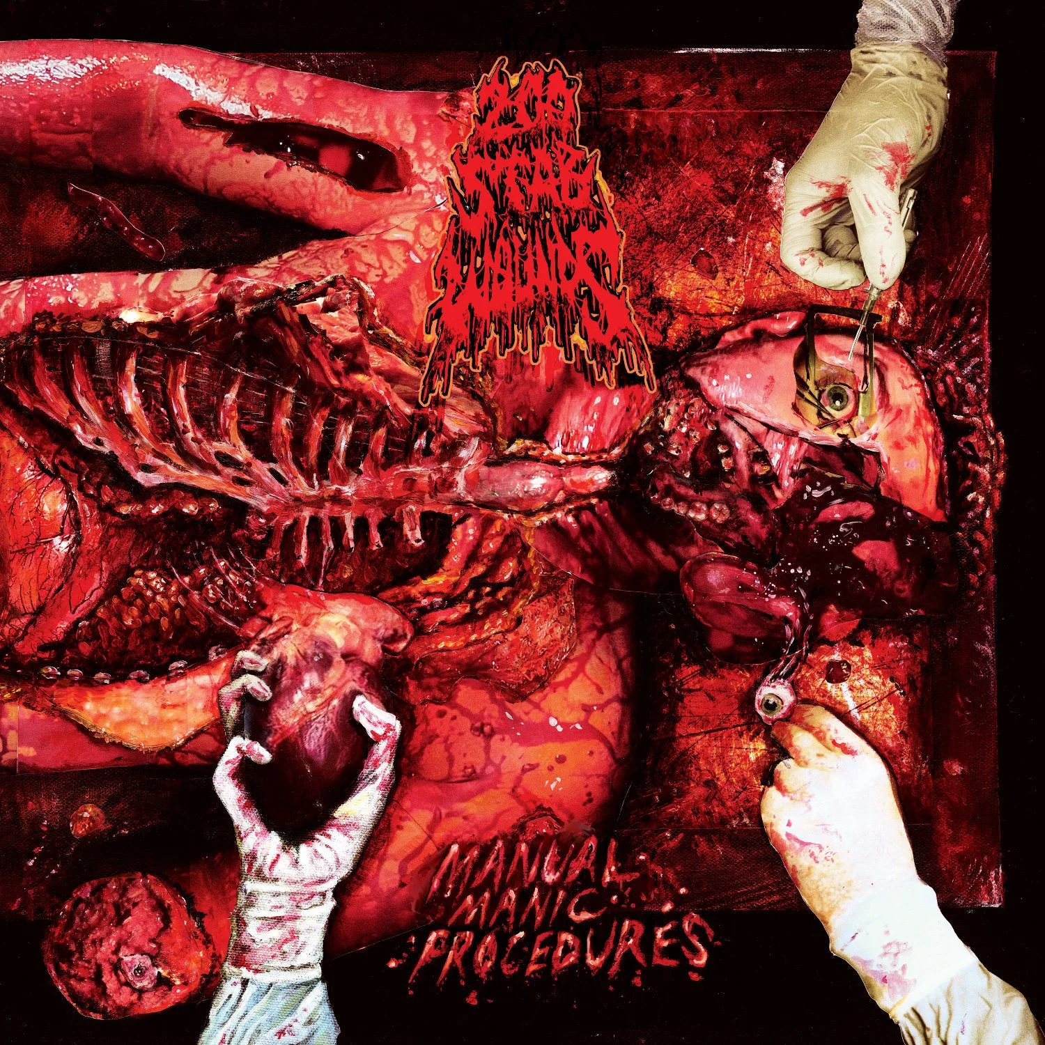 200 STAB WOUNDS | "Manual Manic Procedures"