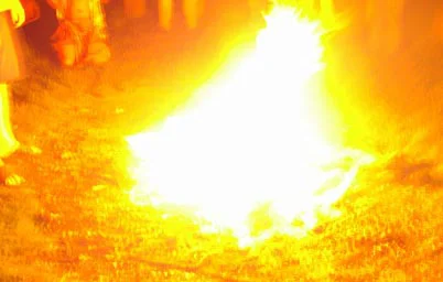 sunbanerburns