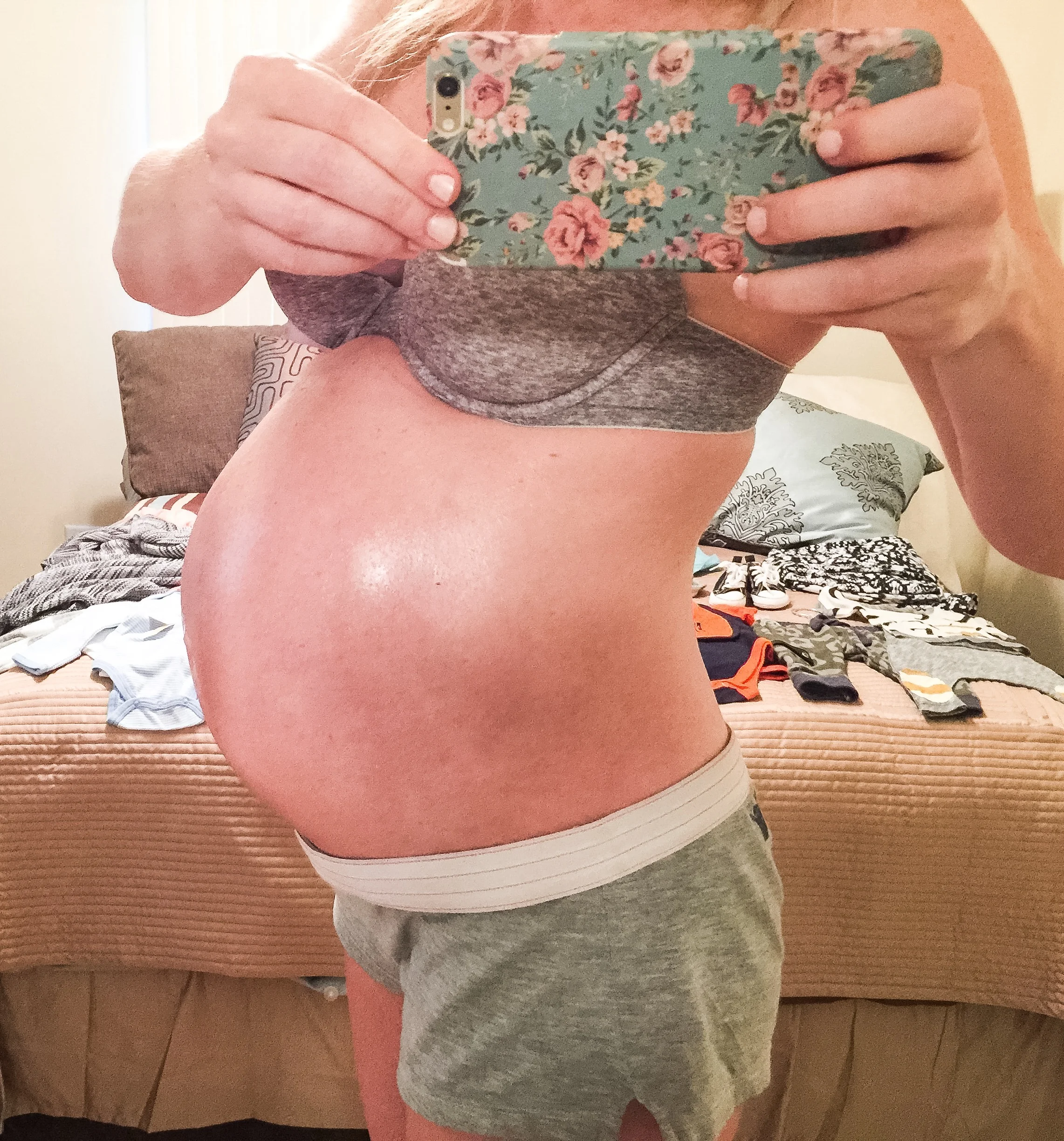 Srom And Pregnancy: Minimizing Risk With [Specific Strategy] - 3ib506n