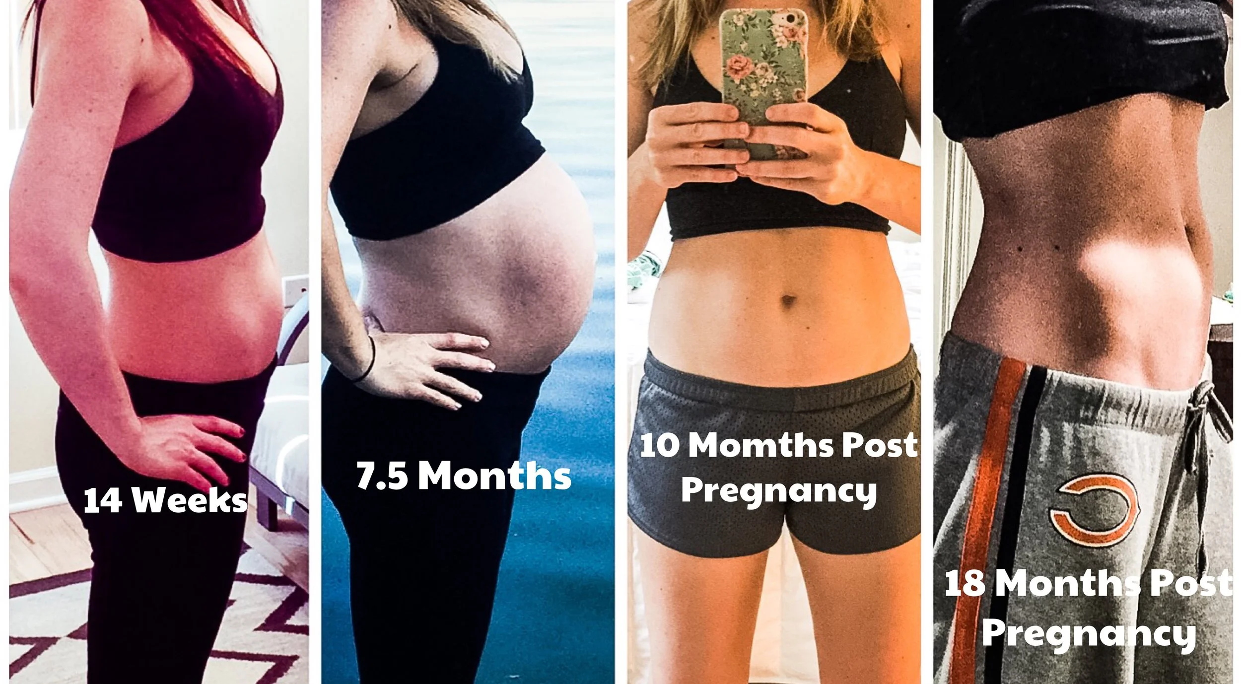 How to Minimize and Possibly Prevent Stretch Marks During Pregnancy