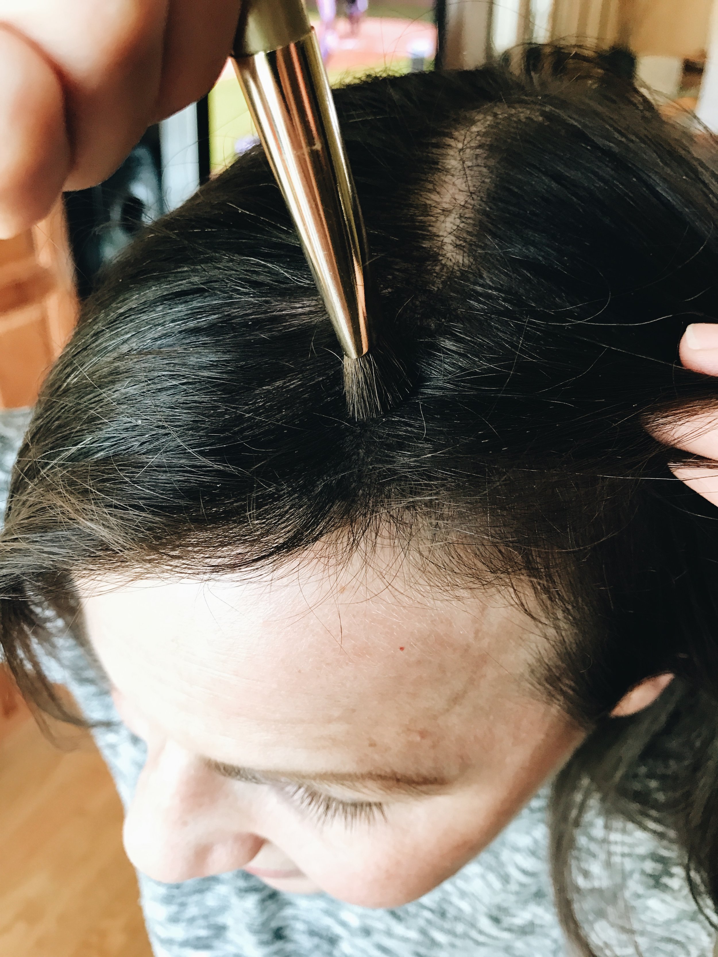 Solutions for Postpartum Hair Loss After Pregnancy — First Thyme Mom