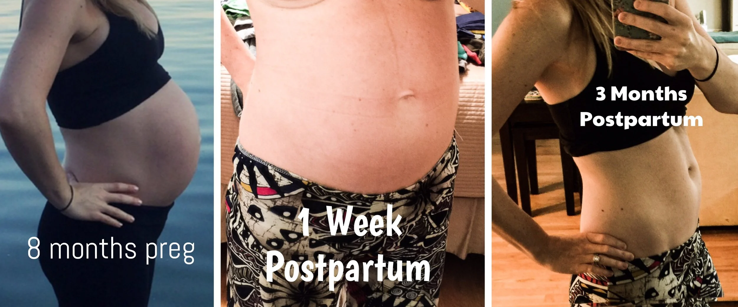 How To Minimize And Possibly Prevent Stretch Marks During Pregnancy First Thyme Mom