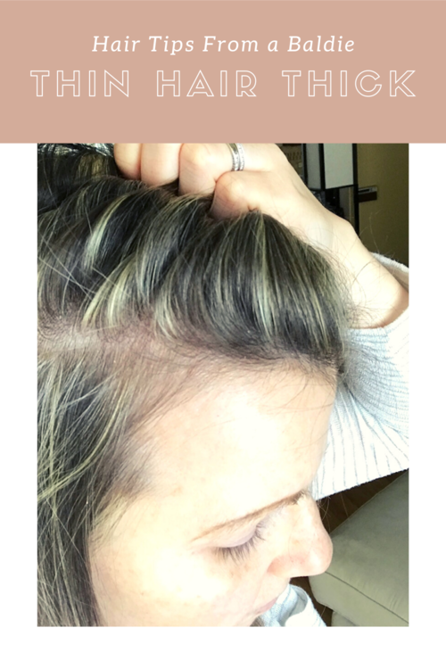 Solutions for thin fine hair. Postpartum hair loss. Comfortable easy to put  on wigs. — First Thyme Mom