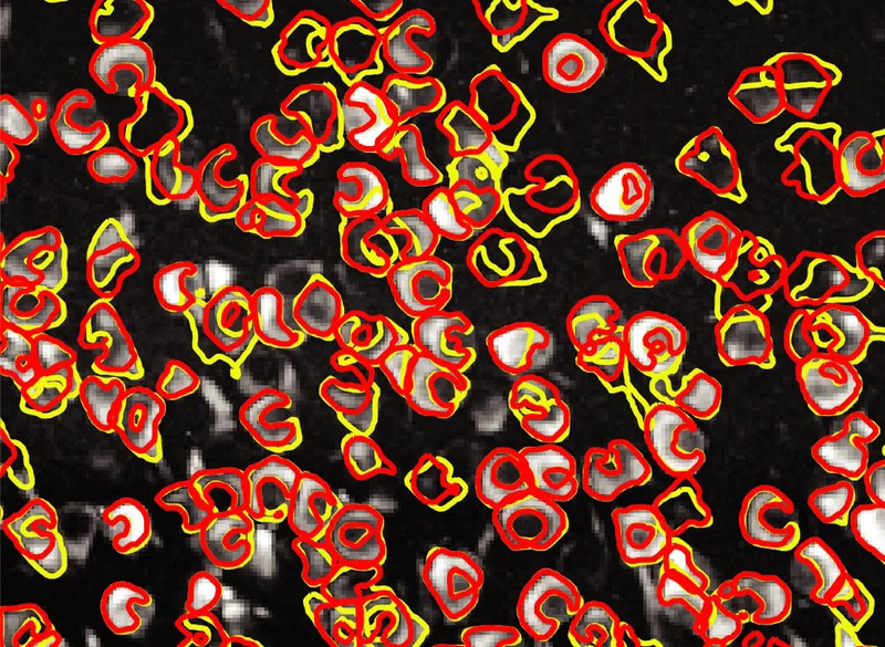 Image: An image of neurons (white) taken using calcium imaging techniques. An innovative software dubbed CaImAn can automatically differentiate between individual neurons (yellow outlines) with nearly the same accuracy as a human (red outlines). Giovannucci et al./eLife 2019.