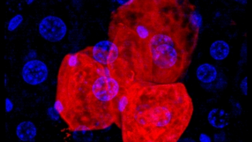 Hepatocyte clones in homeostasis