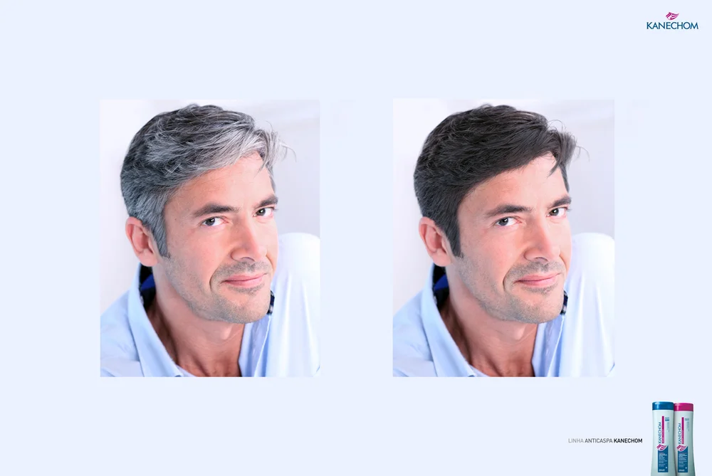 Kanechom_Anticaspa.jpg