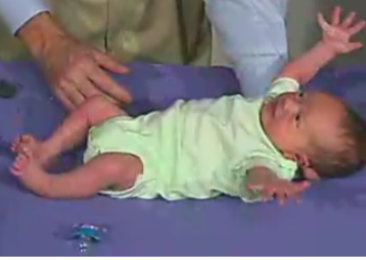 Moro Reflex