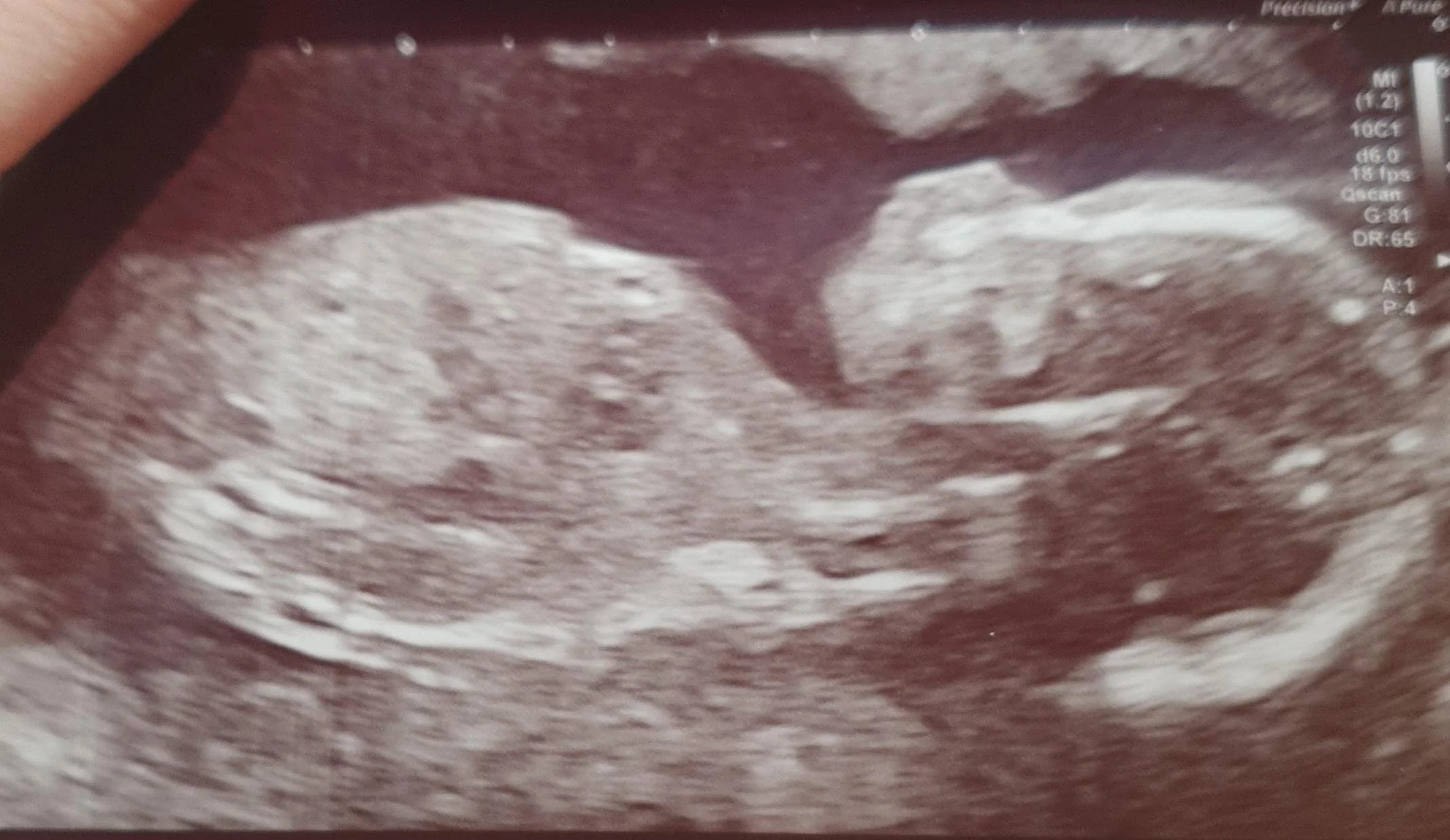 MicrosoftTeams-image (6).png