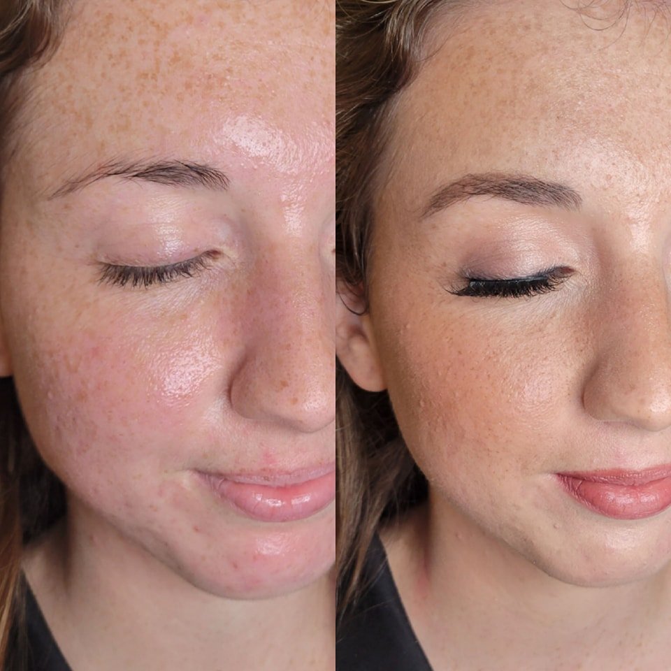 I love freckles 🥰🥰

For more information on me and my services click here:
www.katilynboyer.com
https://booknowwithkatilyn.as.me/