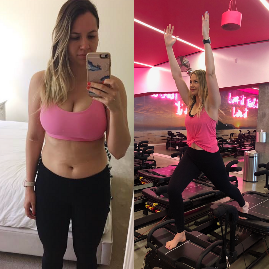 Bernette before and after