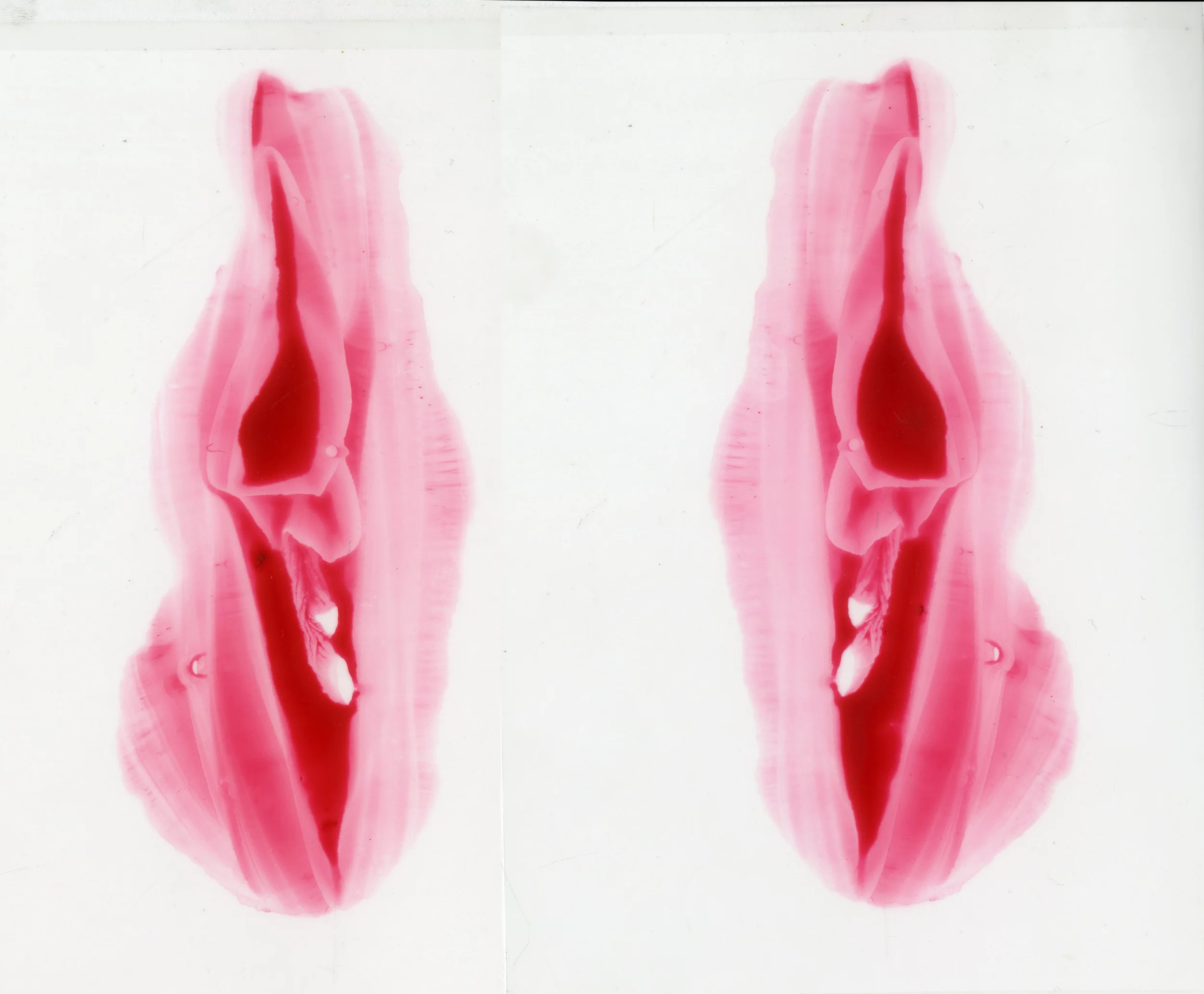 Twins (Copy)