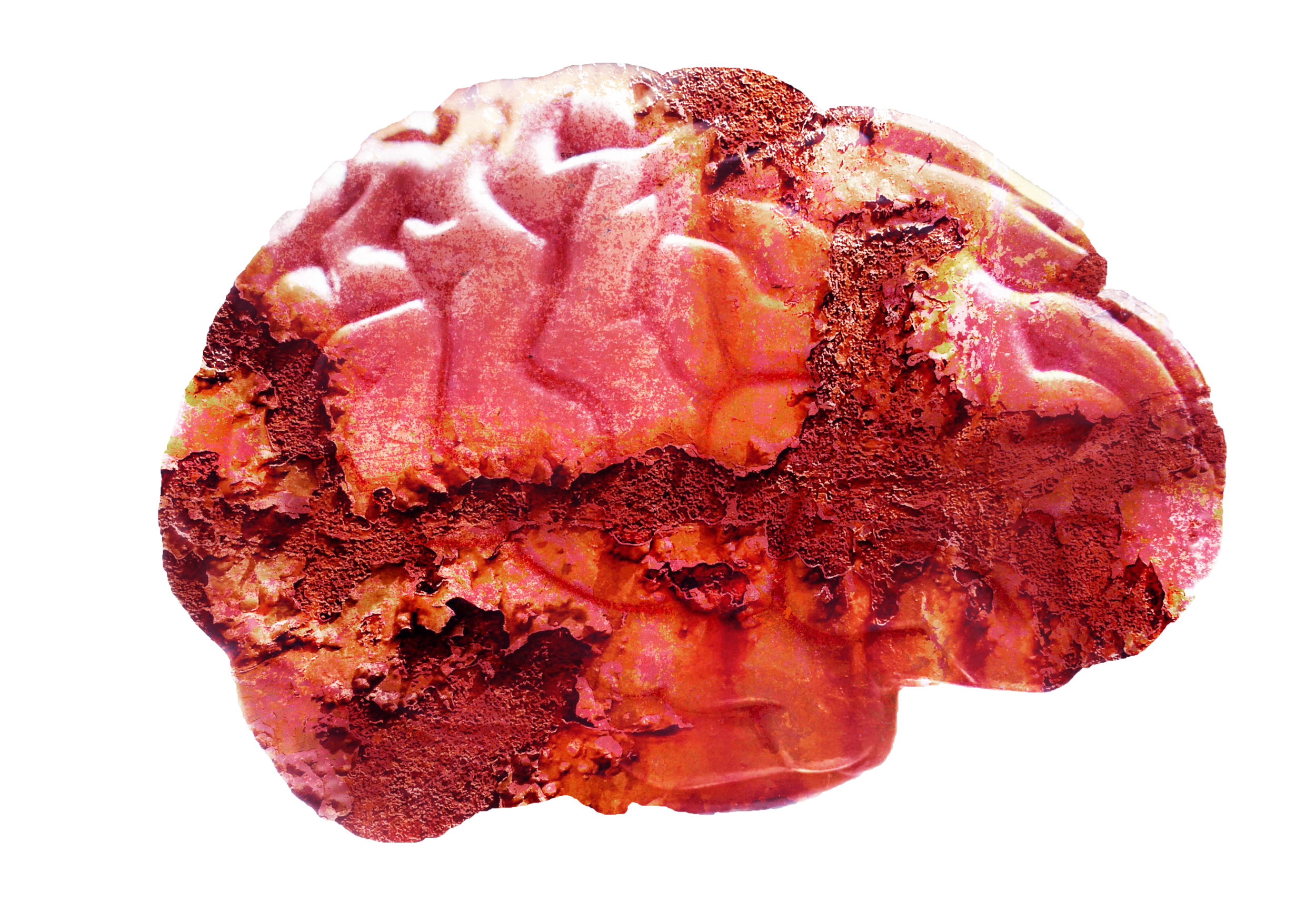 rust-brain-final.png