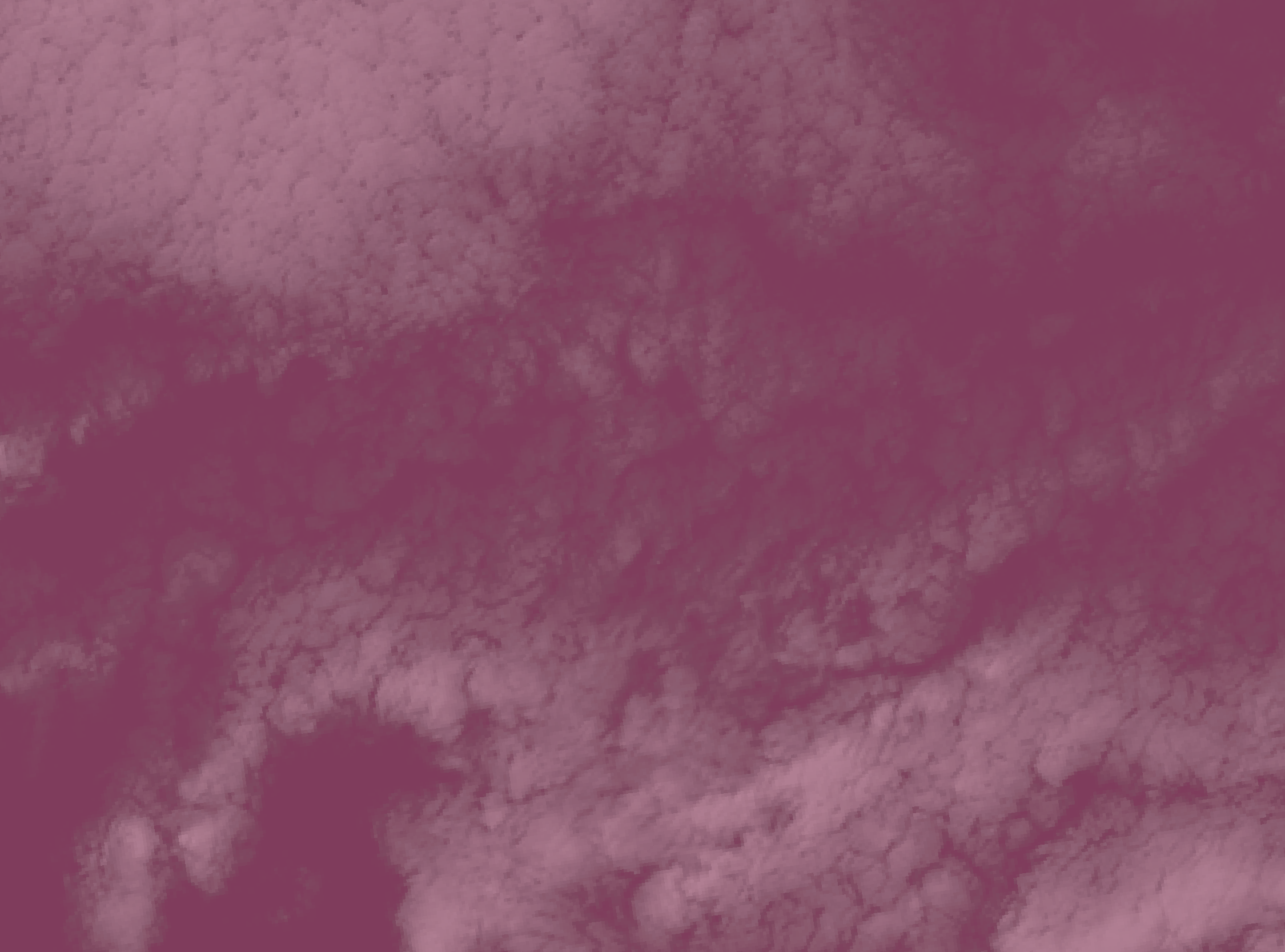 Ten Reasons to do an Organic Acids Test from Great Plains Laboratory