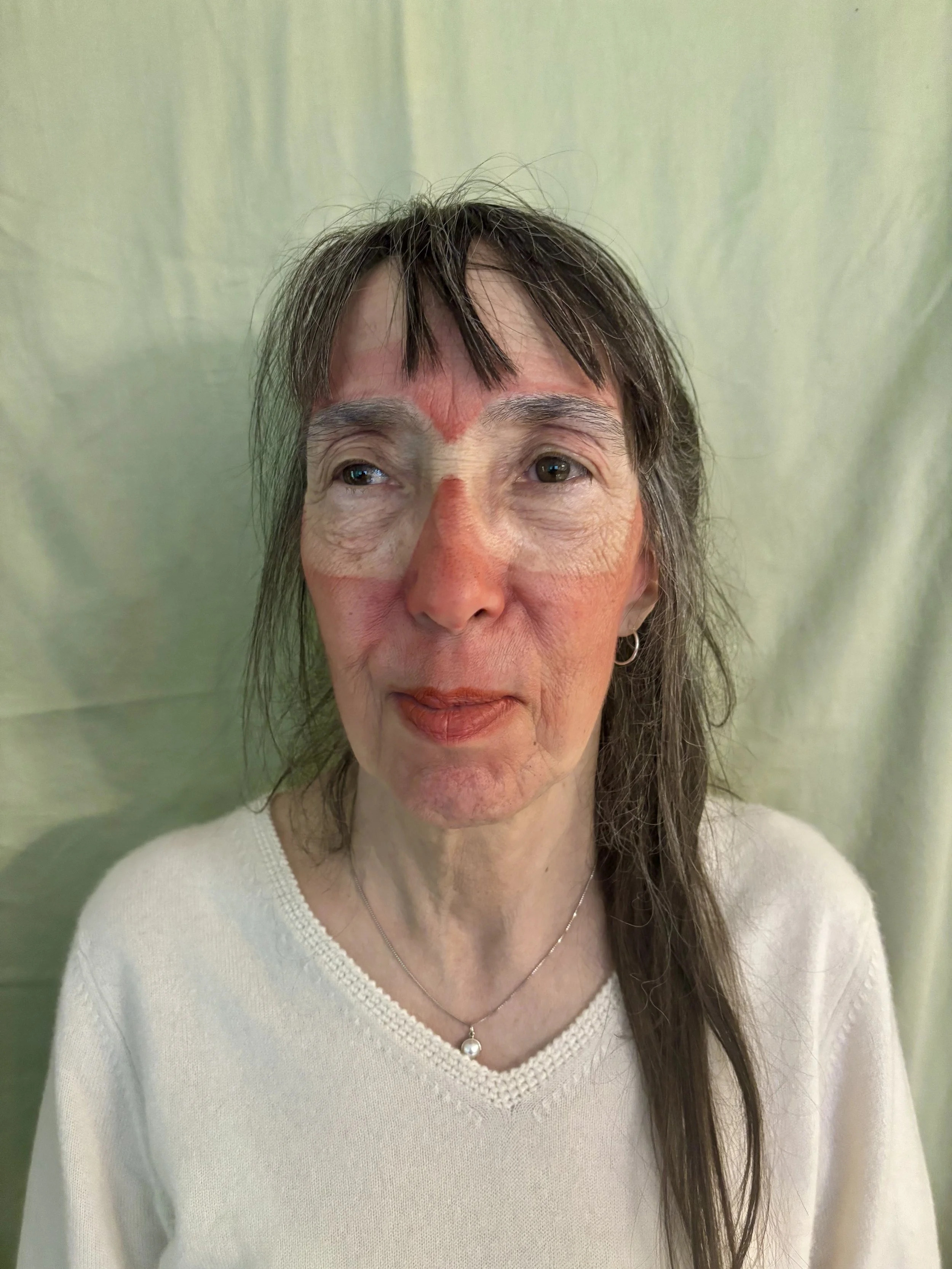camera ready sun burn/hot weather exposure