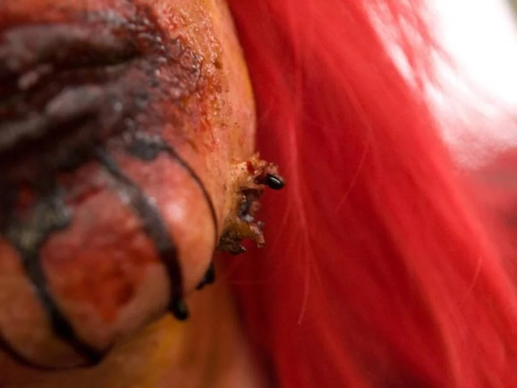 zombie advnaced exit shot wound.jpeg
