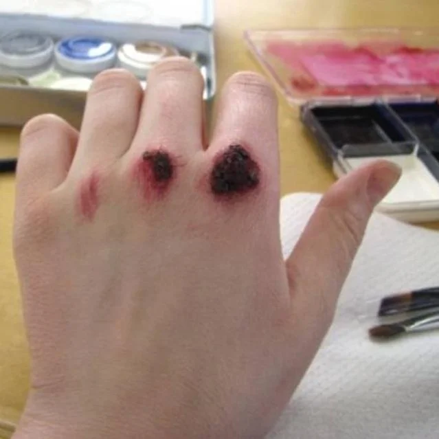 knuckle+scabs.jpg