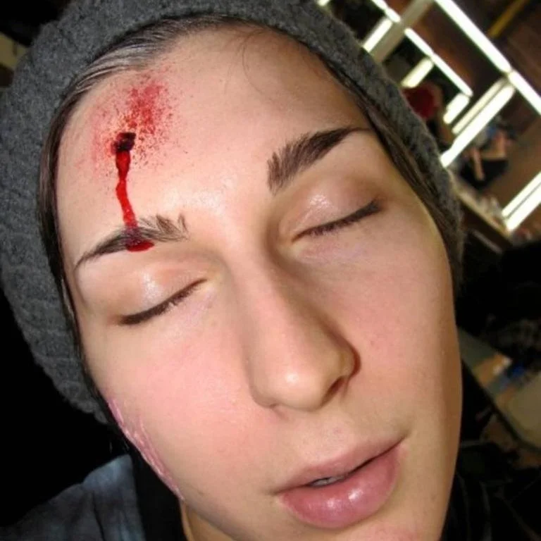 shot+wound.jpg