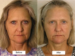mcbeforeafter-4.jpg