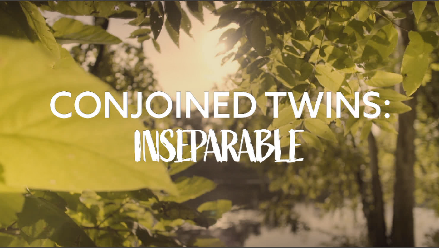 Conjoined Twins: Inseparable main title