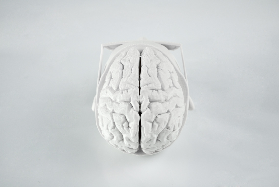 Alan-Nguyen-3D-Printed-Brain-02.jpg