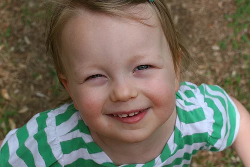 Why Do I Keep Getting A Bloody Nose?