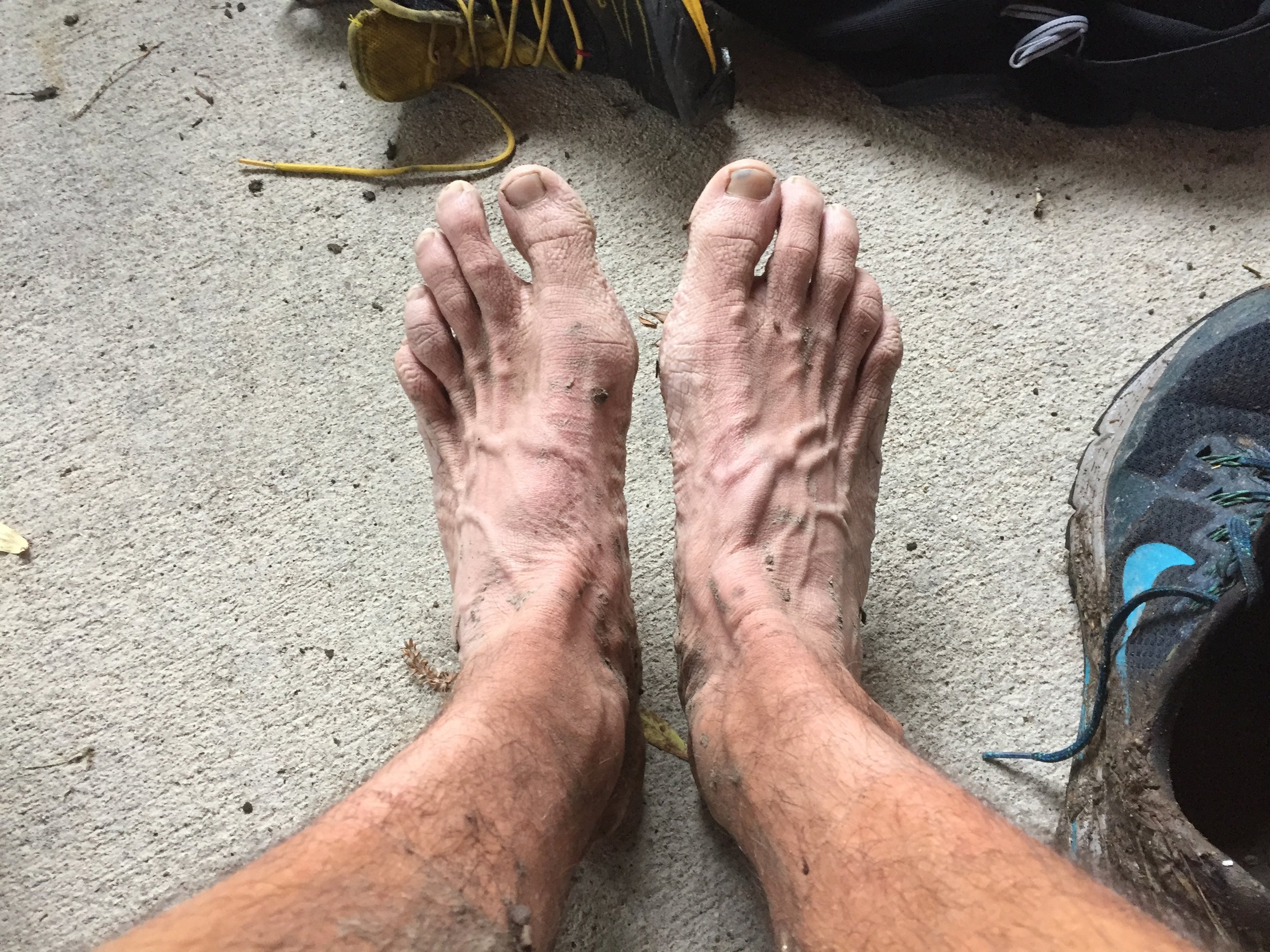 Pruned feet after 100 miles