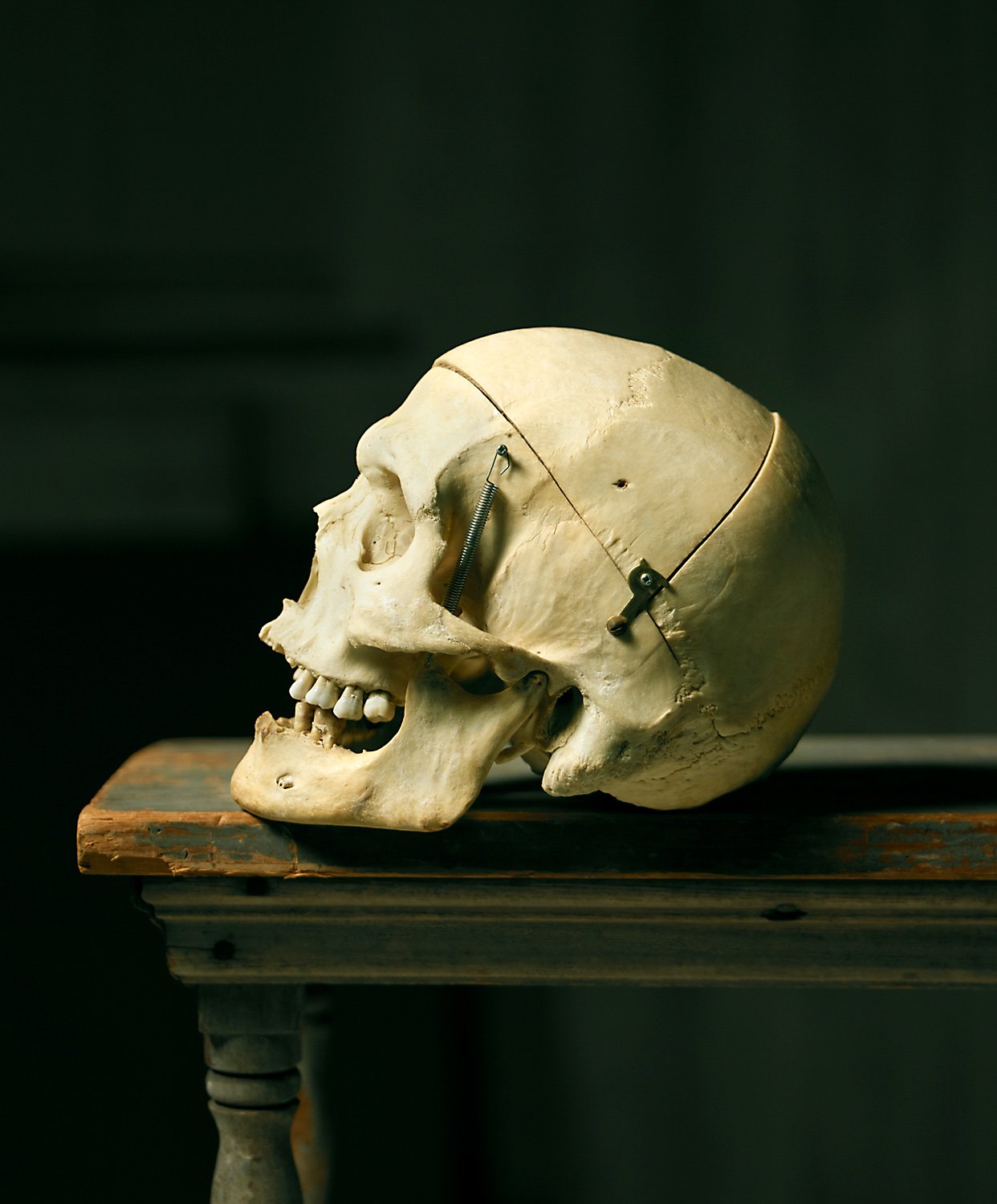 DEL CLOSE’S SKULL