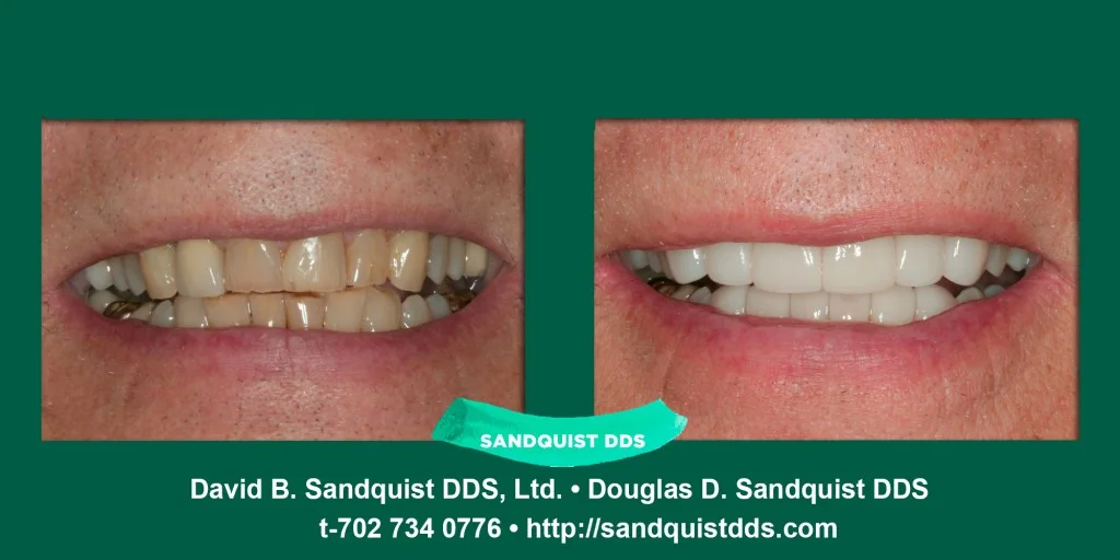 sandquist-sc.jpg