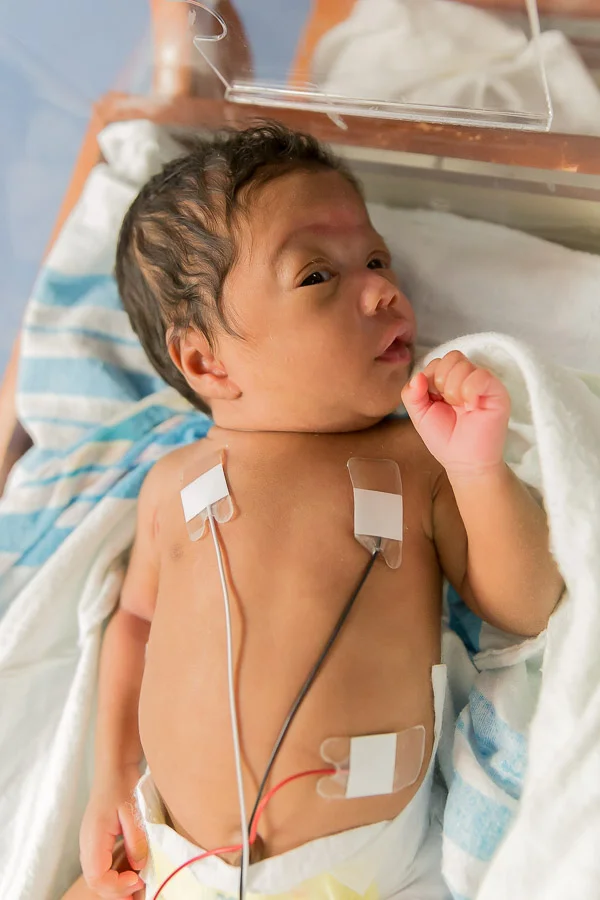 Dreya | 27 Week Preemie | NICU Portraits | Charlotte, North Carolina NICU Photographer | Krista Gantt Photography