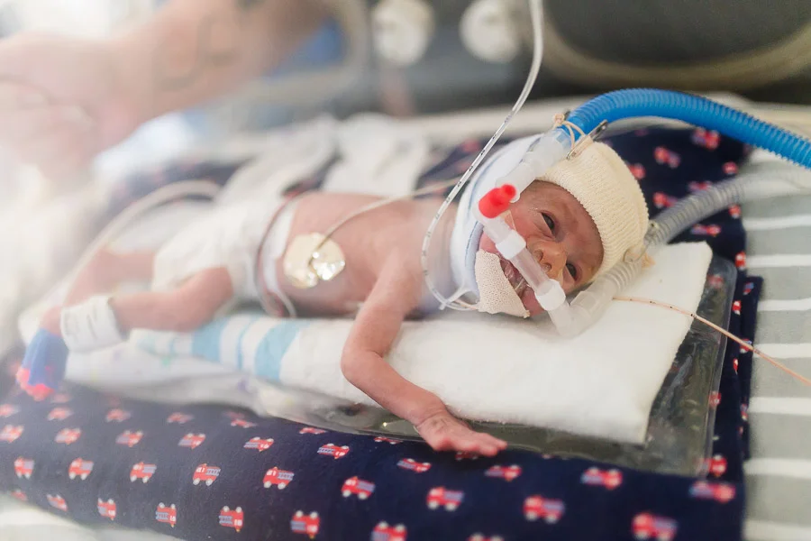 Jaxson | 25 Week Preemie | NICU Portraits | Charlotte, North Carolina NICU Photographer | Krista Gantt Photography