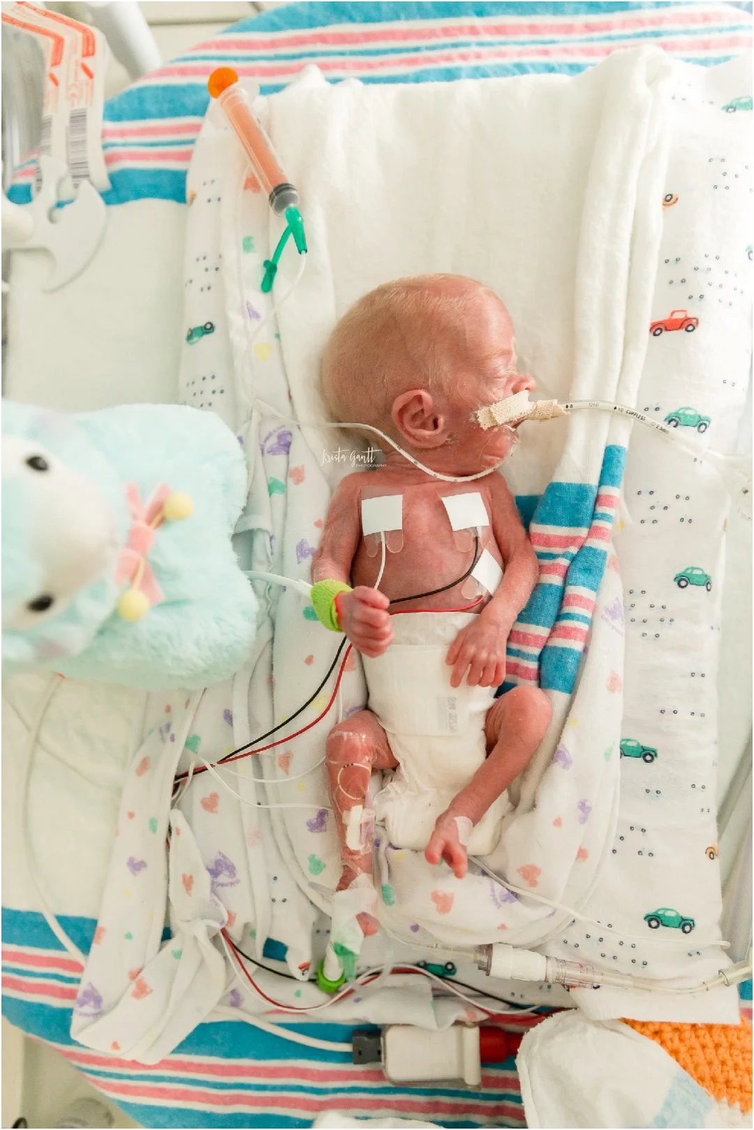 Charlie, An Angel | 26 Week Preemie | NICU Portraits | Charlotte, North Carolina NICU Photographer | Krista Gantt Photography