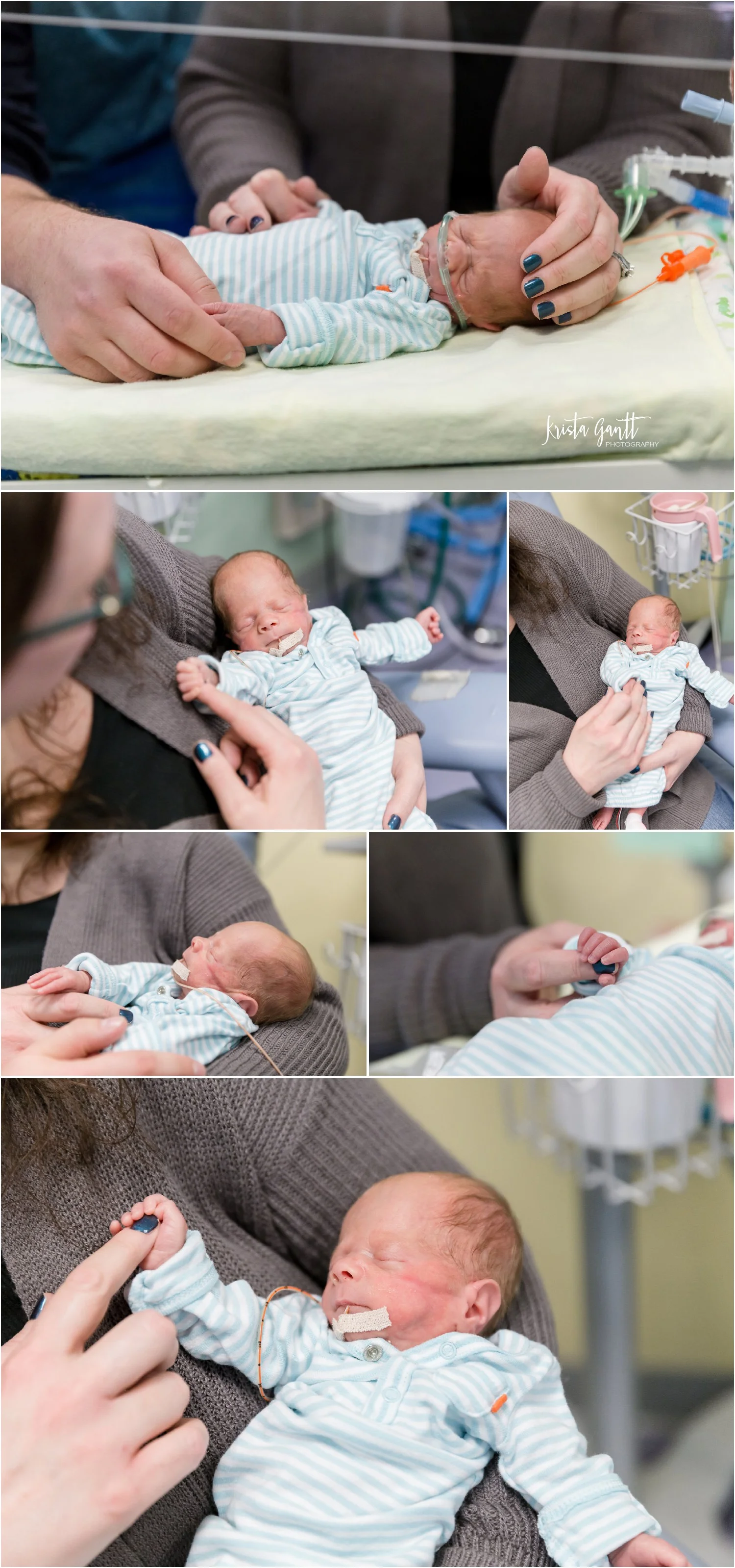 27 weeks fetus pictures
