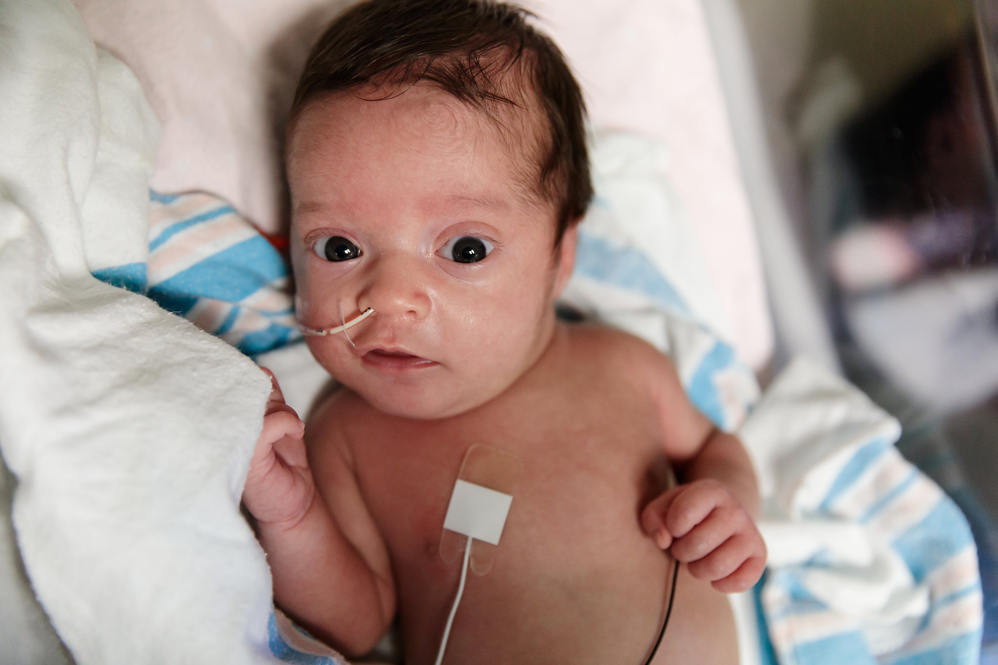 31 week premature baby