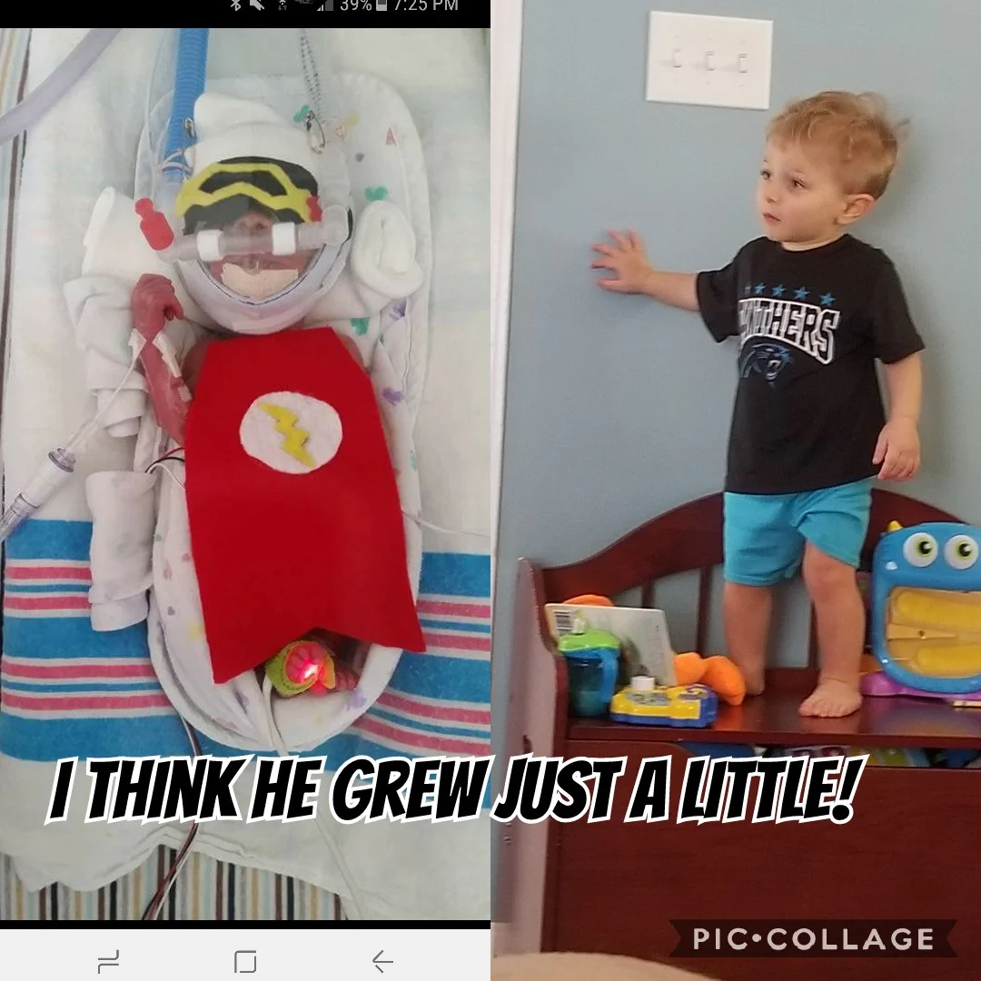 27 Week NICU Grad Ty Turns Two | Charlotte, North Carolina Photographer | NICU Photographer | Krista Gantt Photography