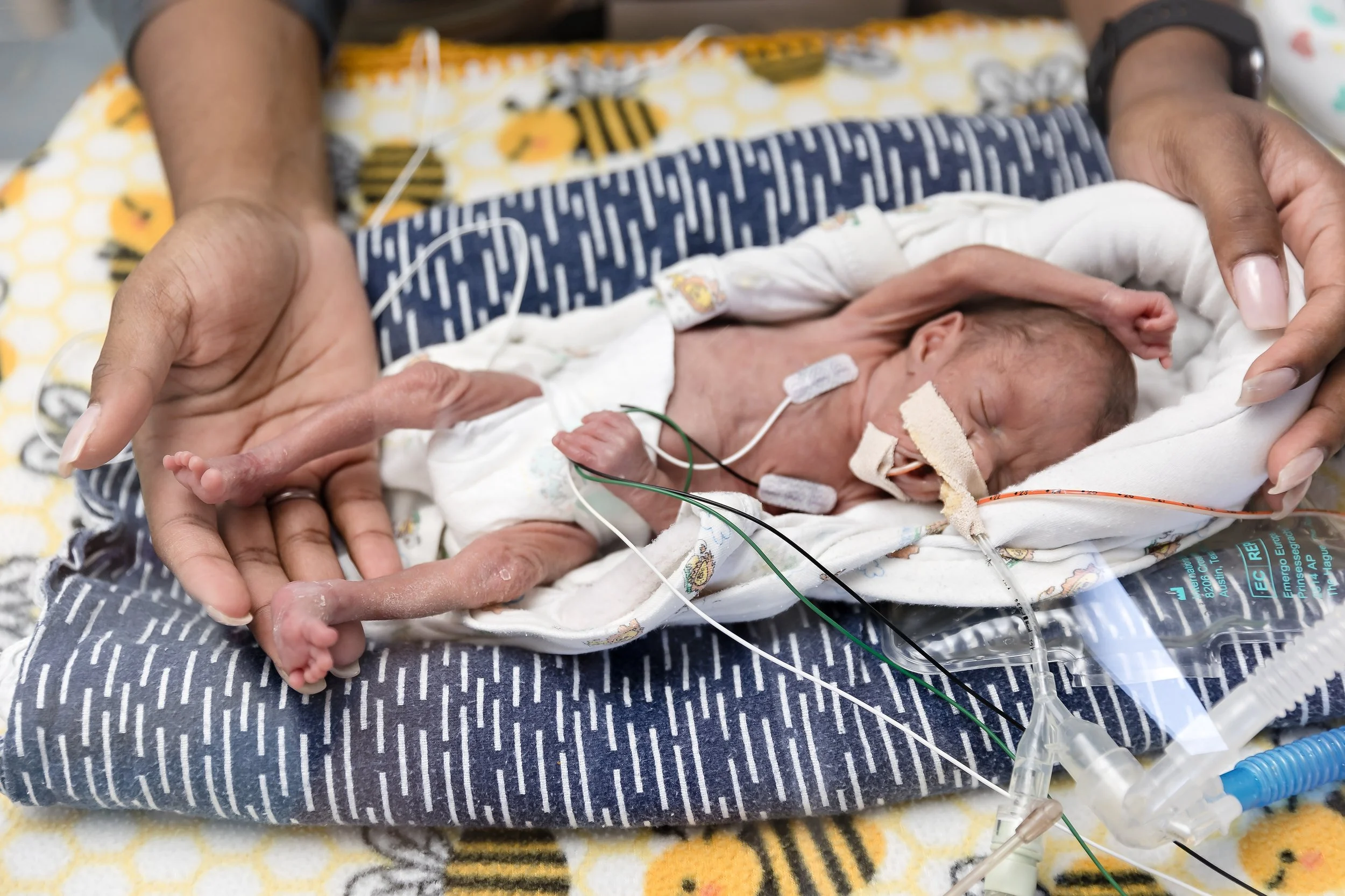 Korban | 23 Week Preemie | NICU Portraits | Charlotte, North Carolina