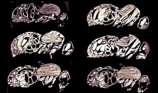 Drosophila yakuba tissue sections stained with a lipophilic dye.