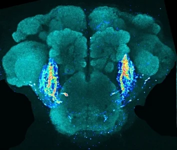 Drosophila brain