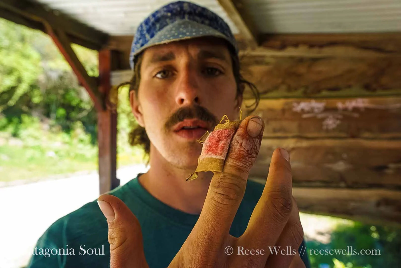 Cut Finger Blues