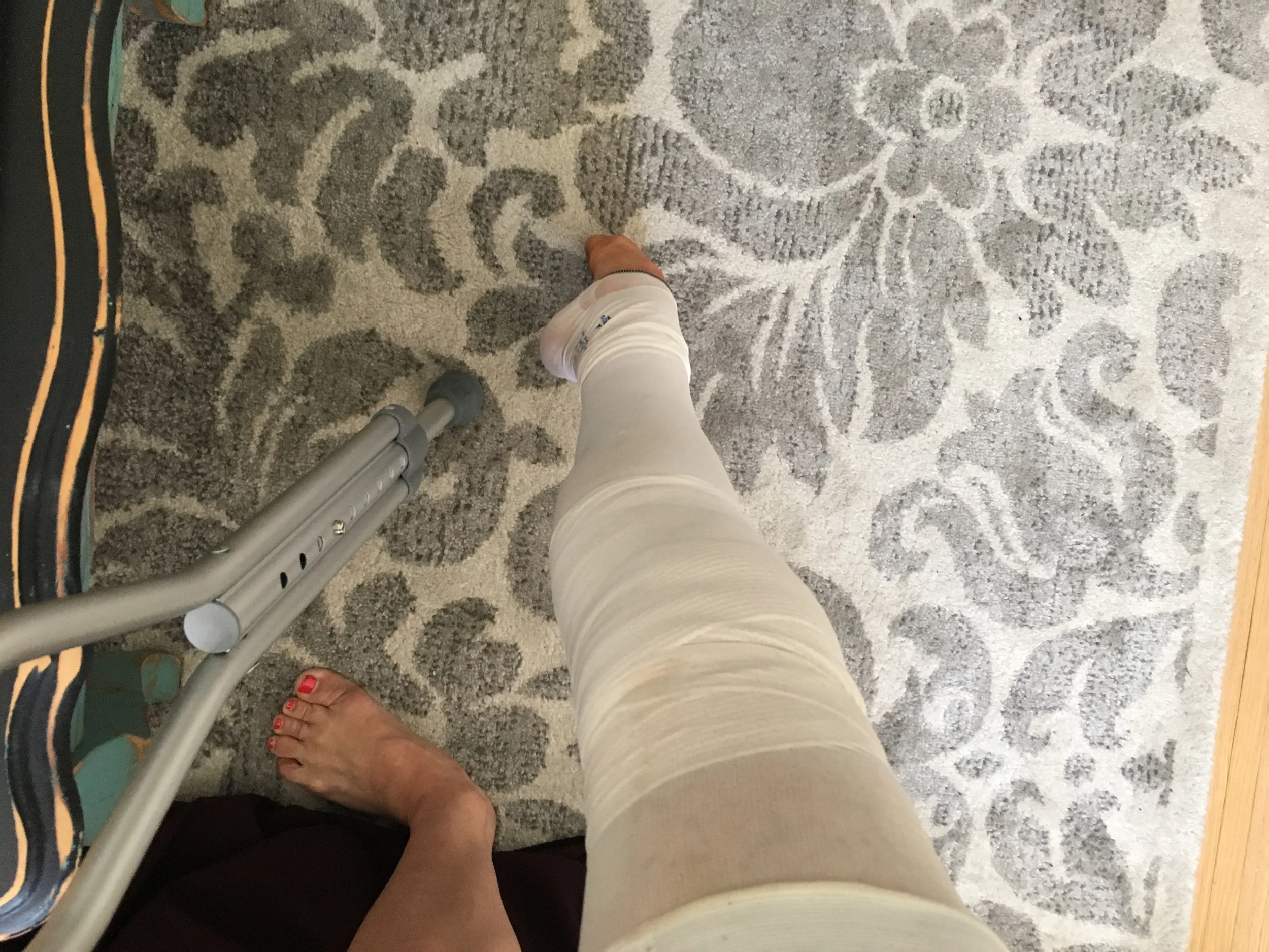 One crutch and a Tondue