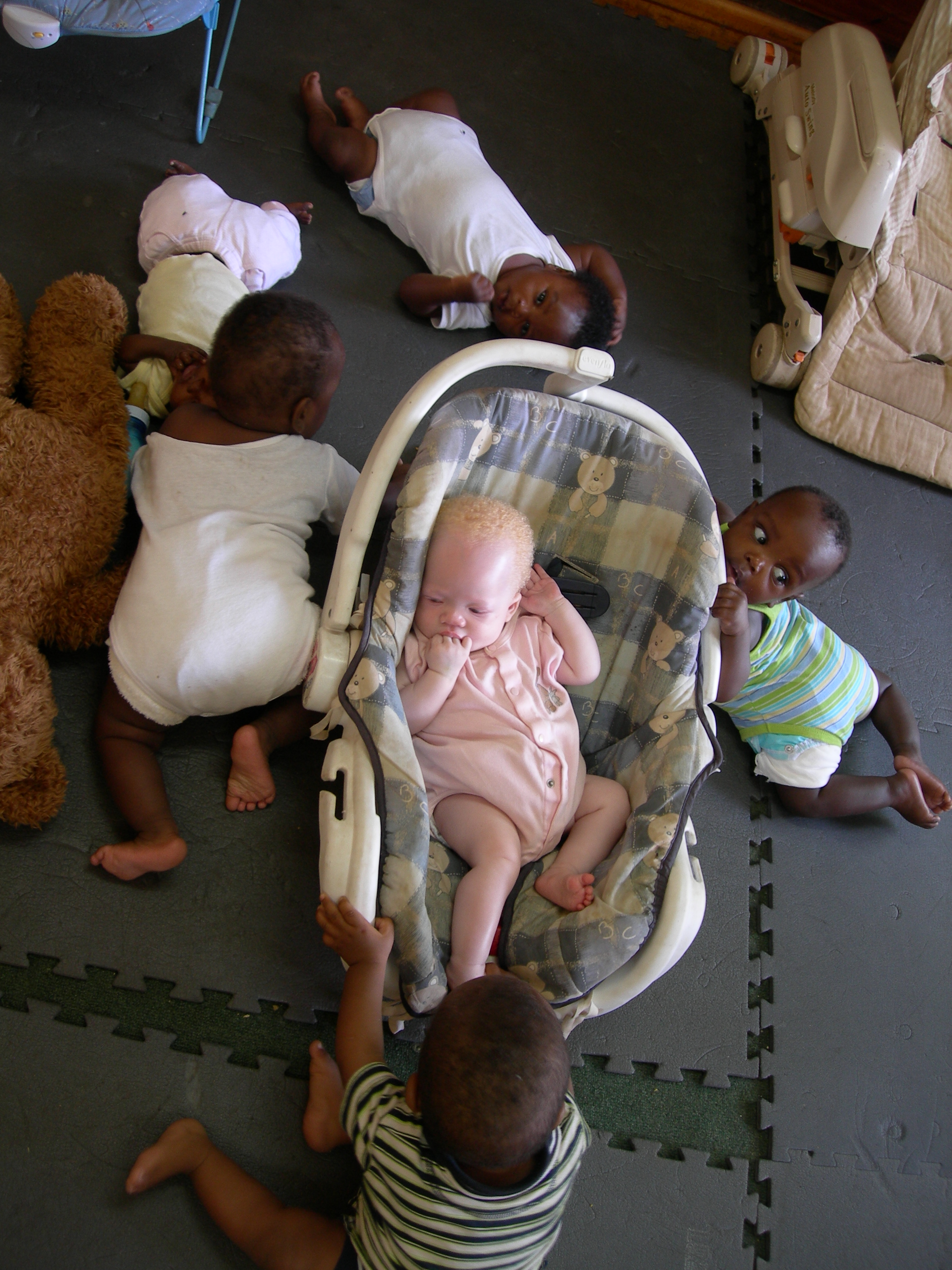 An African with albinism. | Credit: Lars Plougmann