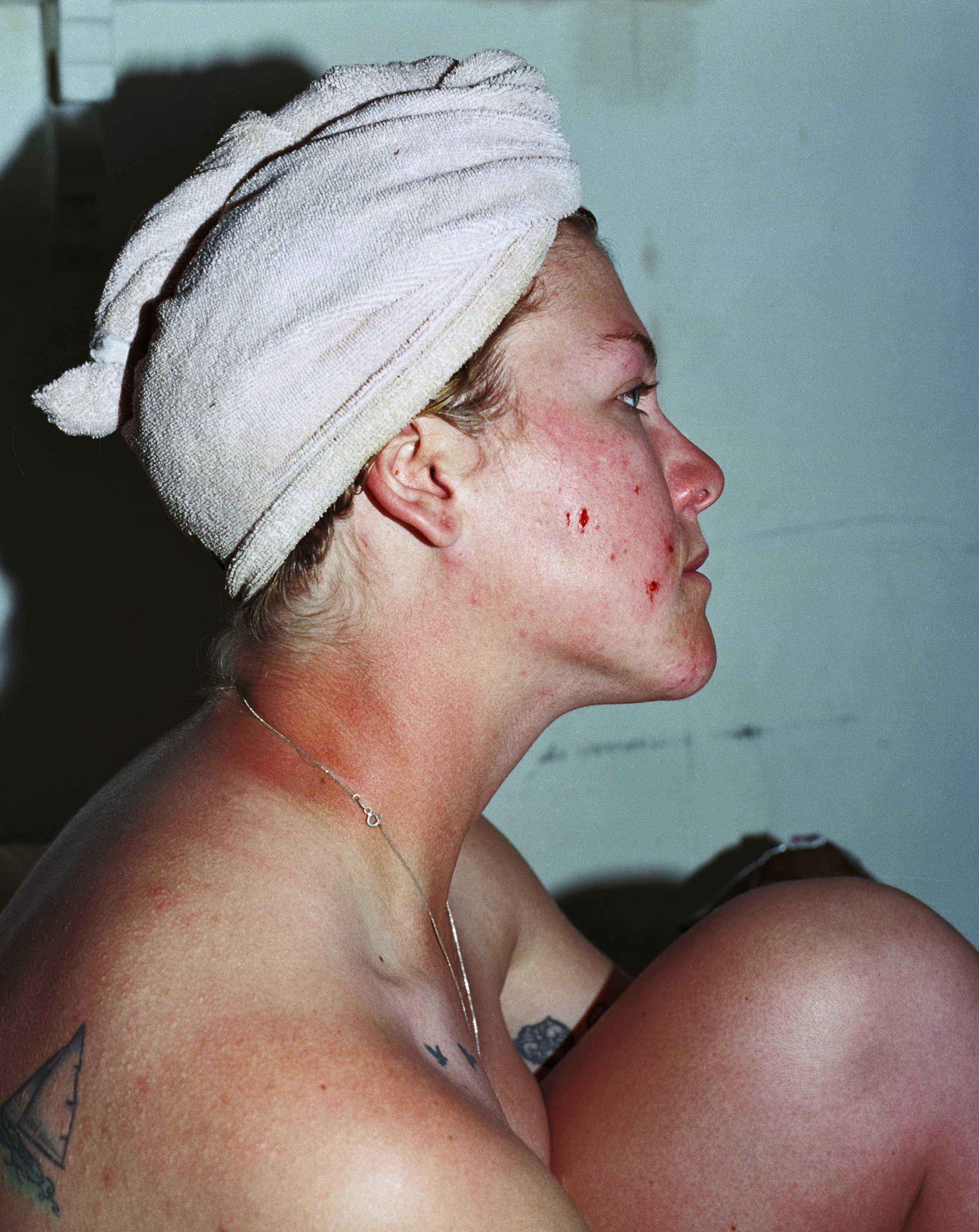 allie with blood on her face2.jpg