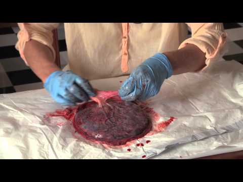 Examining a placenta with Kay Hardie Independent Midwife