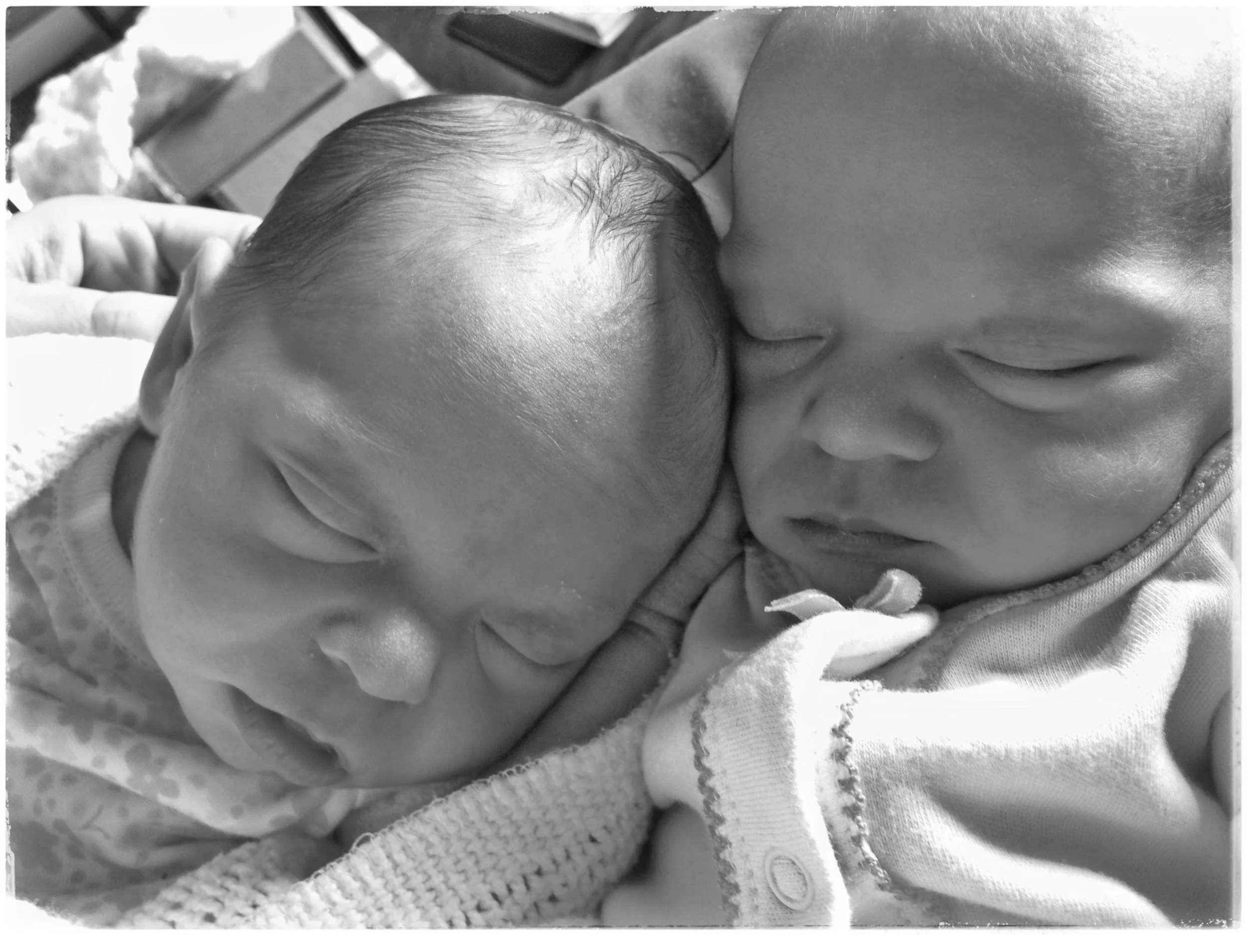 Birth of Lorna's twins by planned C-Section