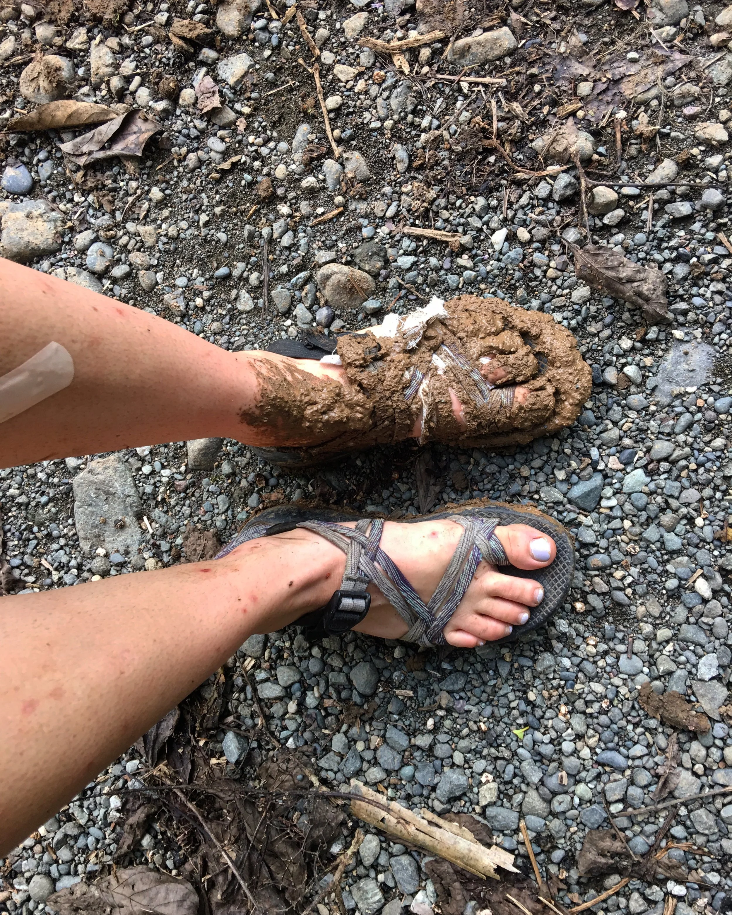 My Feet Stink