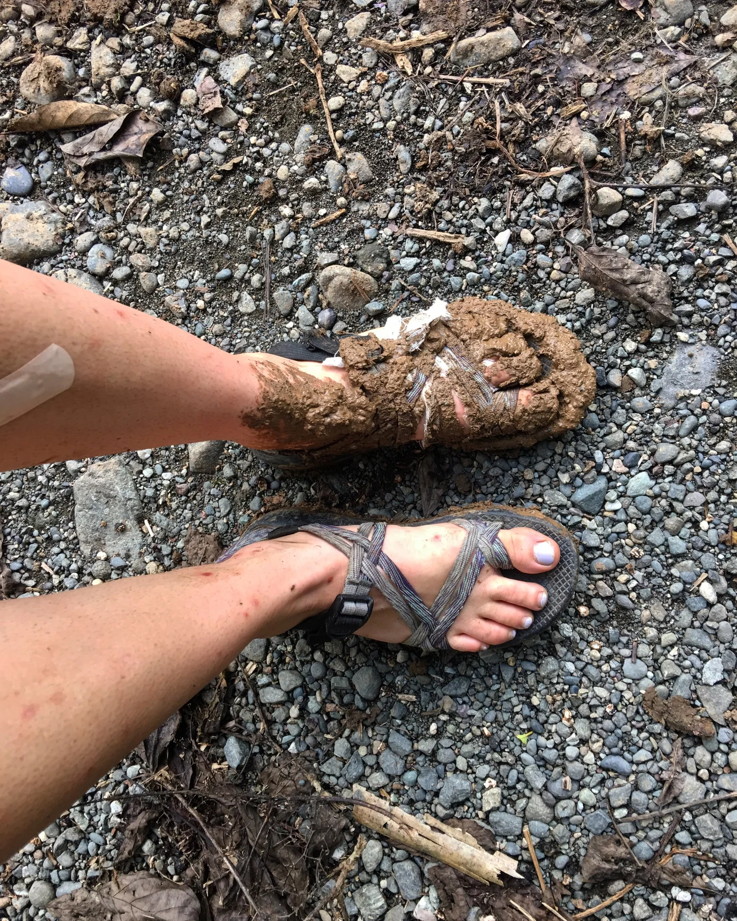 My Feet Stink Vidbee