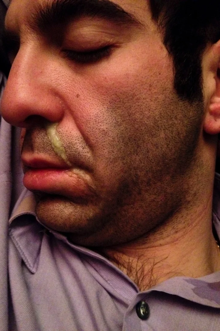 scrill snot coming from sleeping nose.jpg
